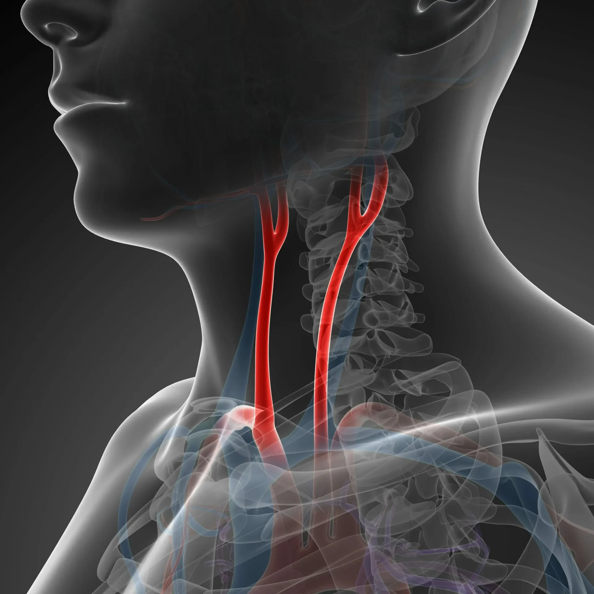Carotid Artery Disease Treatment Madurai